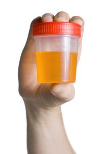 Urine Container